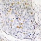 Anti-RPS27L Antibody